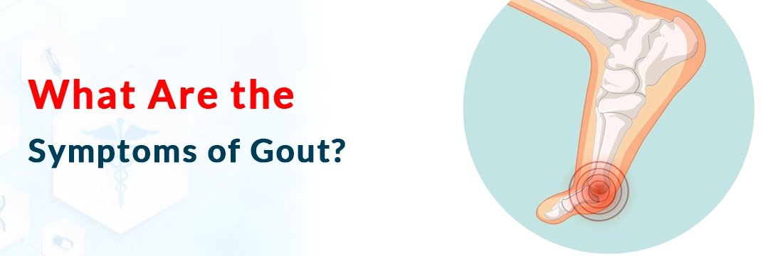  What Are the Symptoms of Gout?